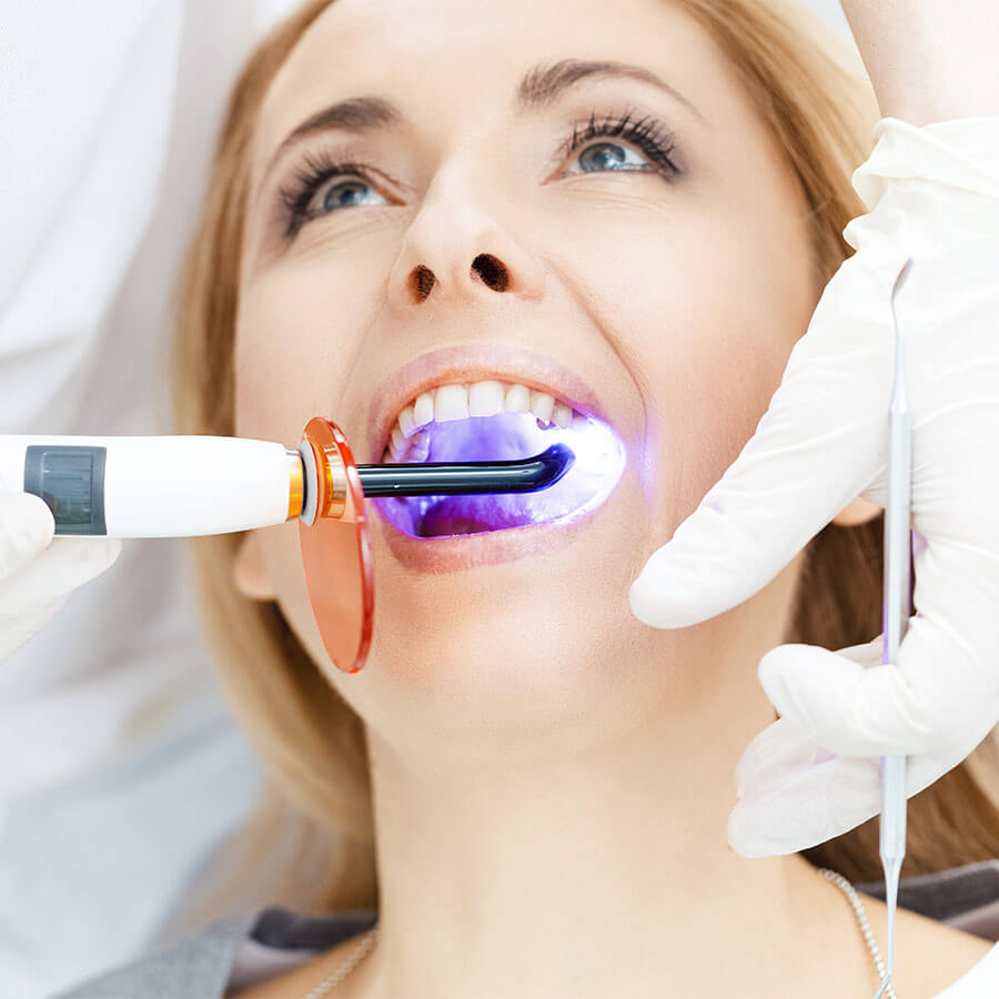 Tooth whitening procedure