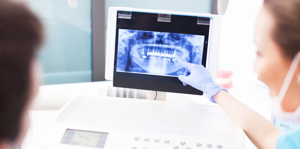 Dental radiography, xrays