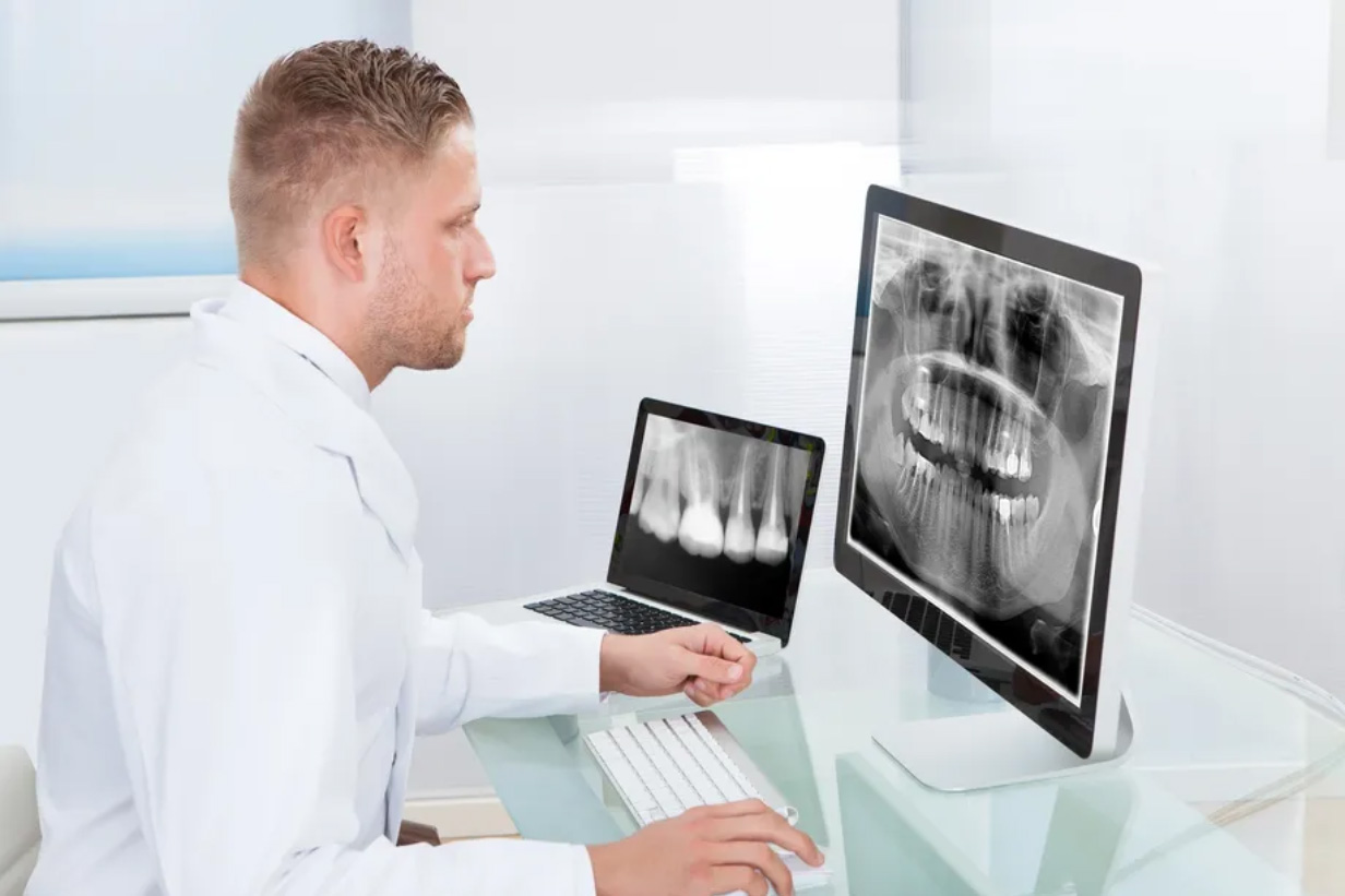 Dental X-rays in Etobicoke