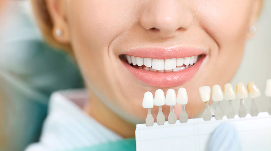 Pearly Whites? What Are Your Teeth Whitening Options - D.R. Dental Clinics